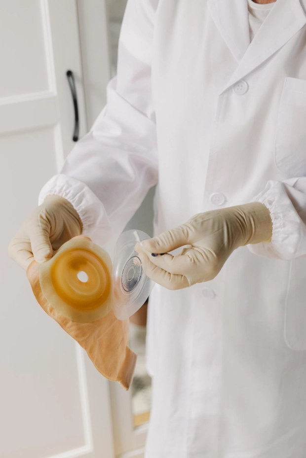 фото врача проводящего реабилитацию после иссечения свища на стоме